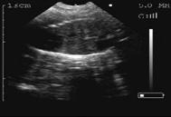 95 days gestation