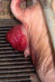 rectal prolapse